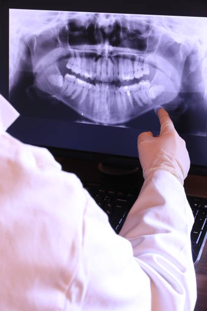 Best Root Canal Emergency Dentist  in Mokena, IL