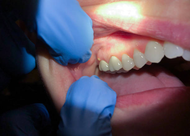 Best Urgent Tooth Repair  in Mokena, IL